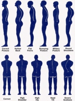media/posture.jpg